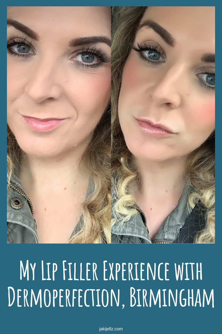 My Lip Filler Experience with Dermoperfection, Birmingham