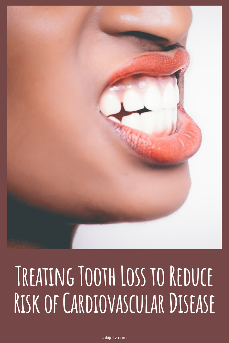 Treating Tooth Loss to Reduce Risk of Cardiovascular Disease