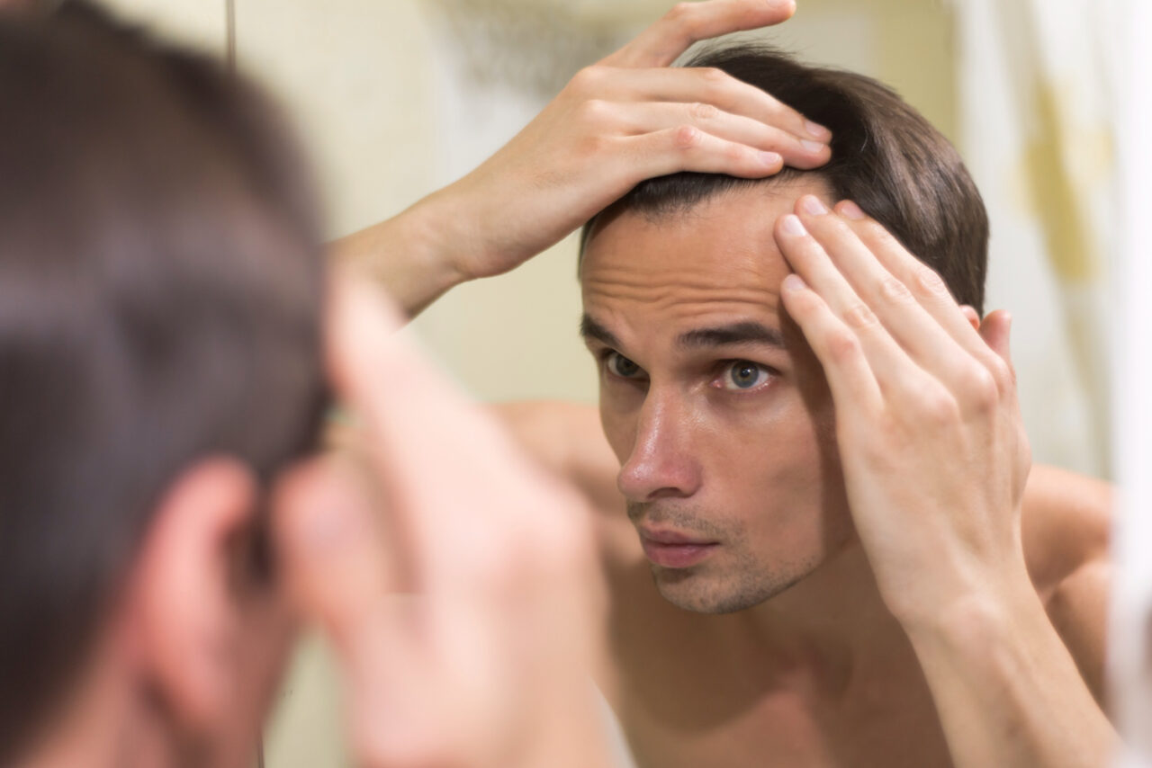 5 Ways to Retain Your Confidence in the Face of Baldness