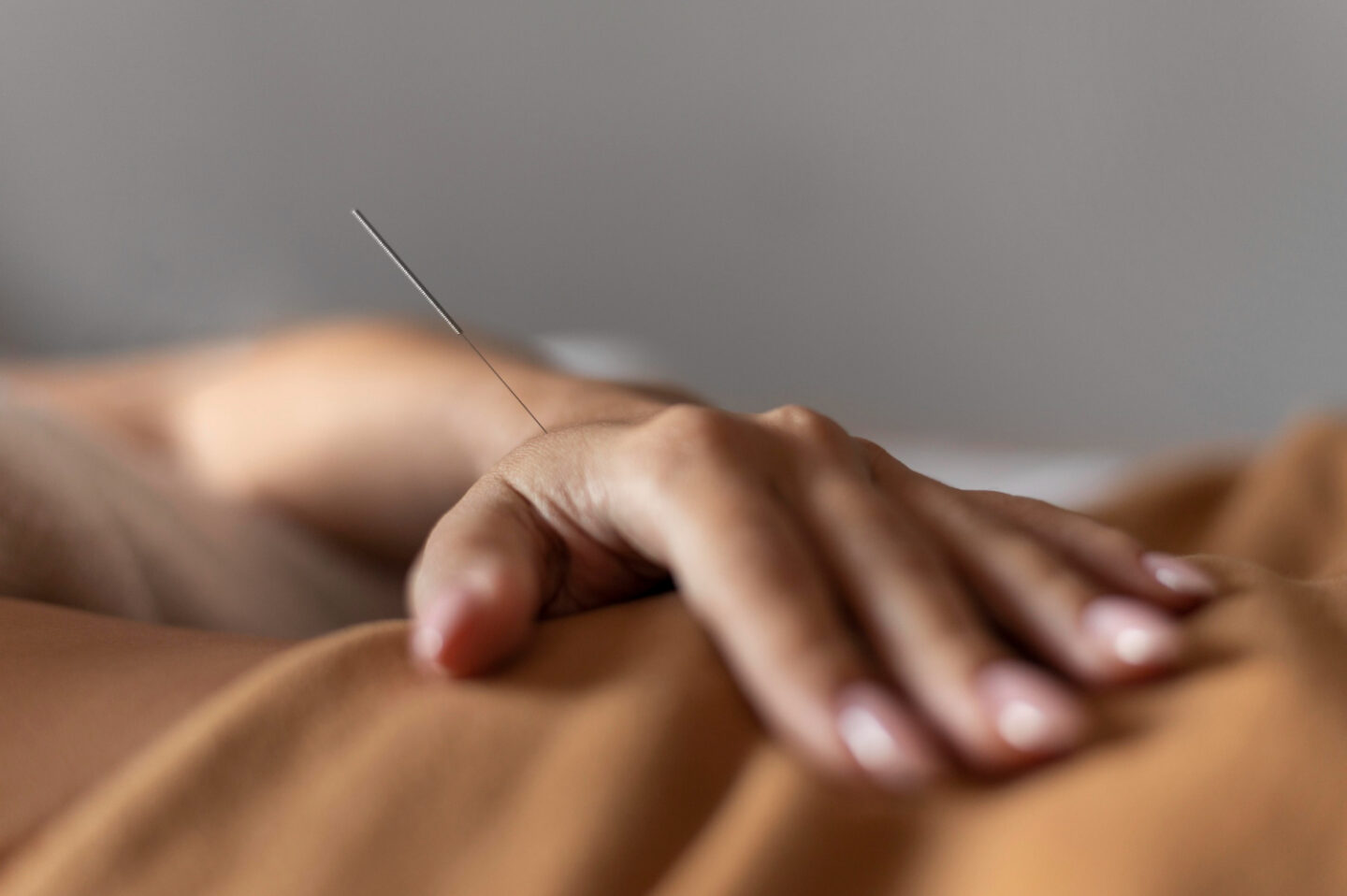 How Dry Needling Targets Trigger Points